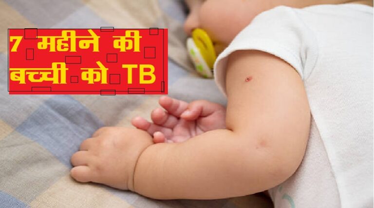 उत्तराखंड : 7 महीने की बच्ची को TB, हैरत में पड़ गए डॉक्टर, इस तरह का पहला मामला!