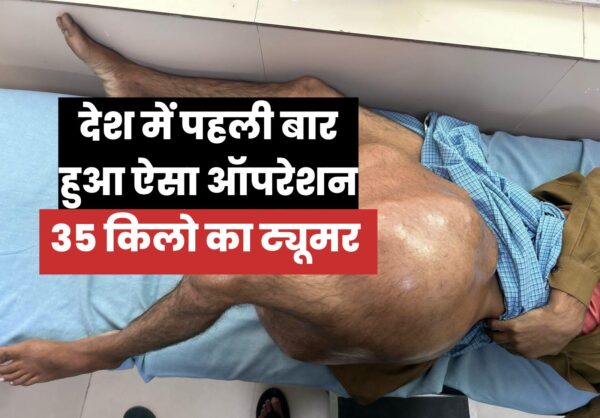 उत्तराखंड : अजब-गजब! डॉक्टरों ने निकाला 35 किलो का बोन ट्यूमर, देश में अब तक का सबसे बड़ा! VIDEO उत्तराखंड : अजब-गजब! डॉक्टरों ने निकाला 35 किलो का बोन ट्यूमर, देश में अब तक का सबसे बड़ा! VIDEO