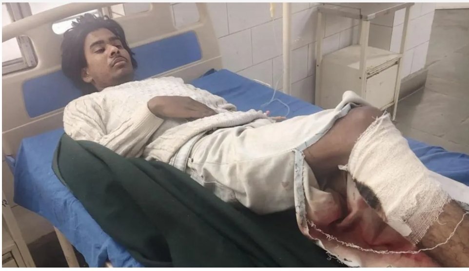 खटीमा तुषार हत्याकांड: मुख्य आरोपी हाशिम पुलिस मुठभेड़ में घायल, गिरफ्तार